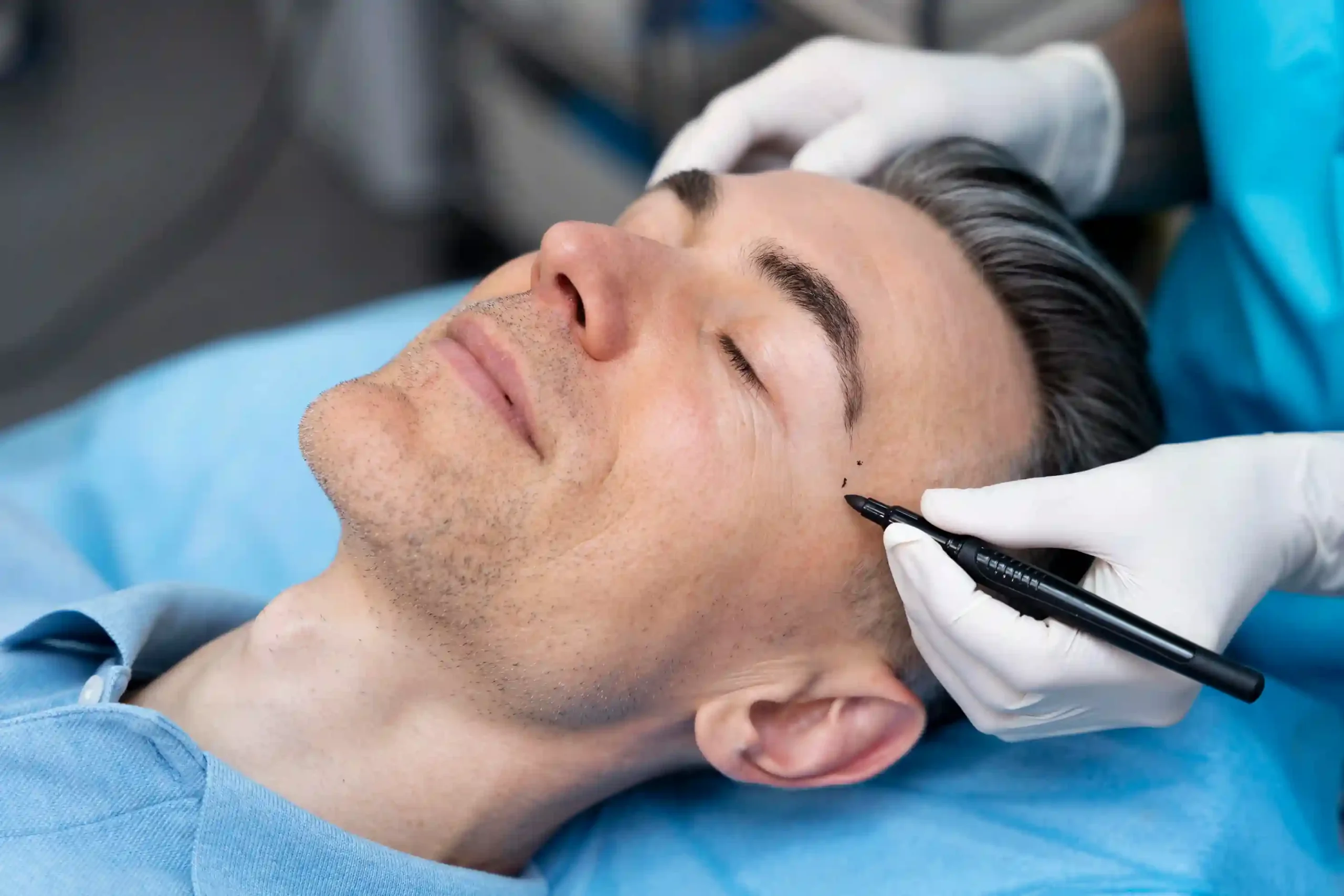 Beard & Eyebrow Transplant at Premier Medical Clinic