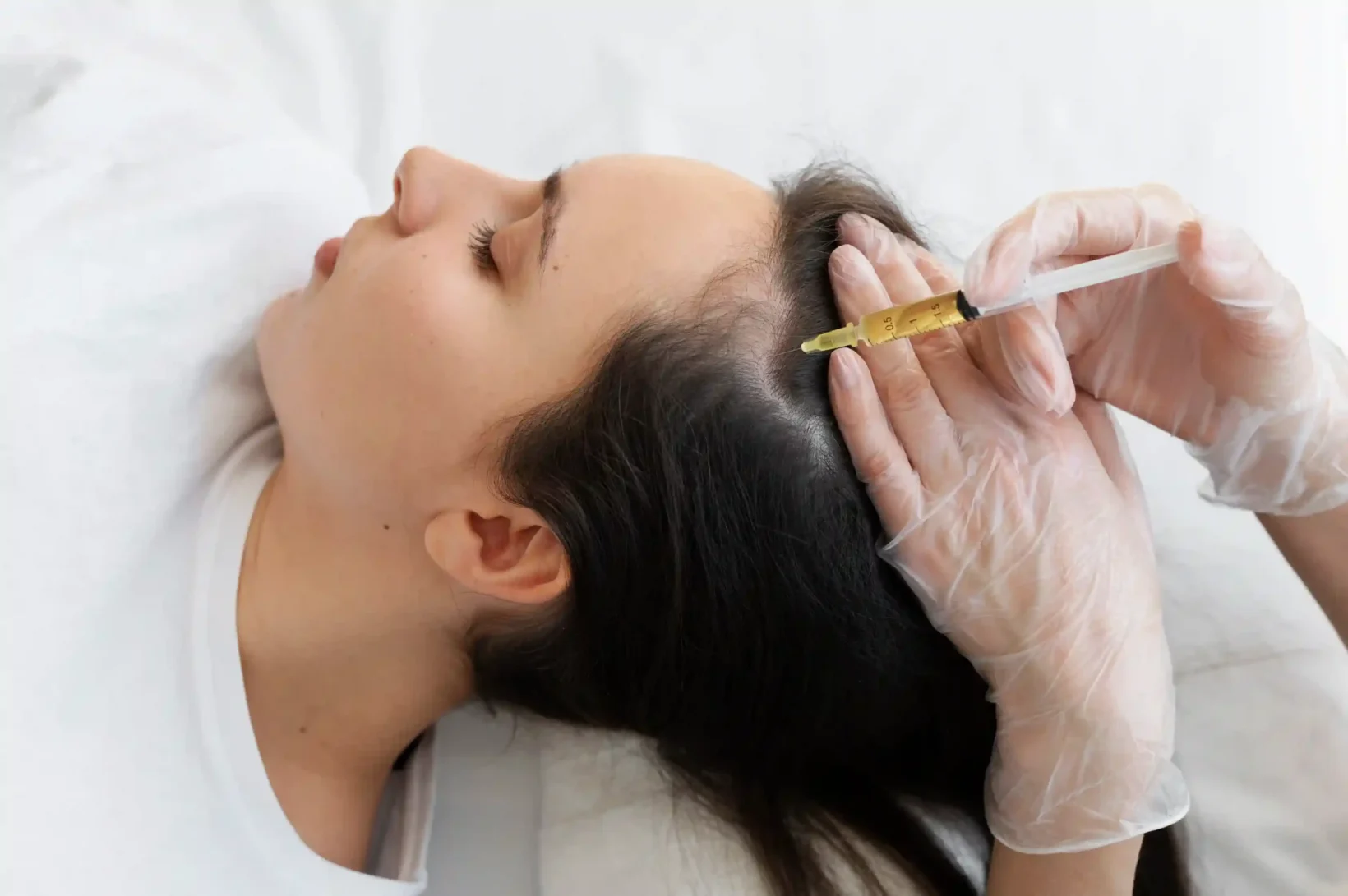 PRP Therapy for Hair Loss at Premier Medical Clinic
